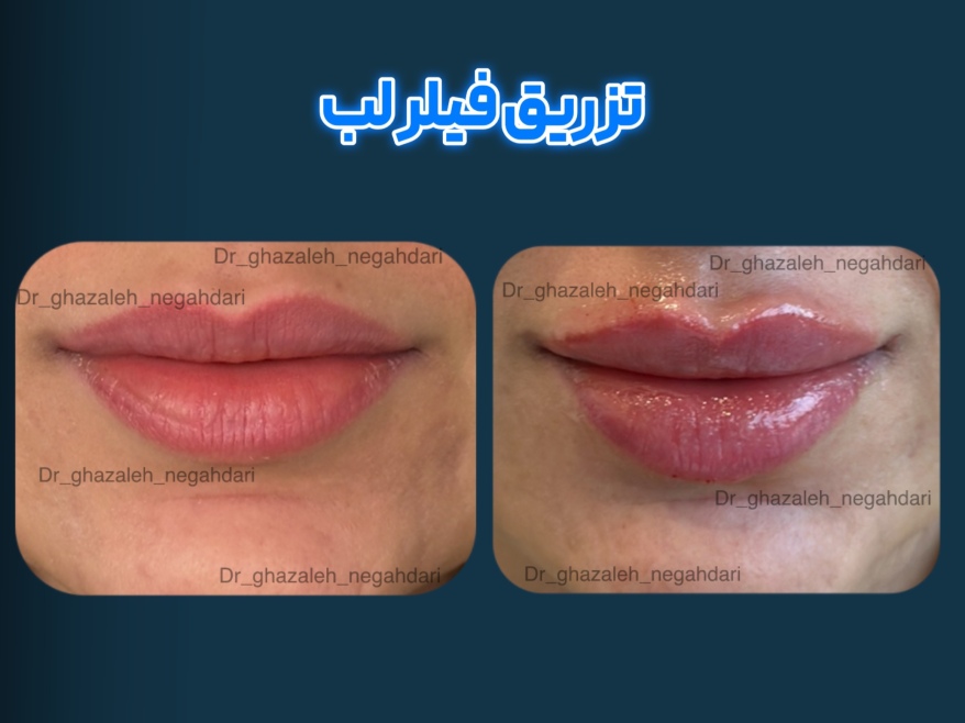 پروژه چهارم